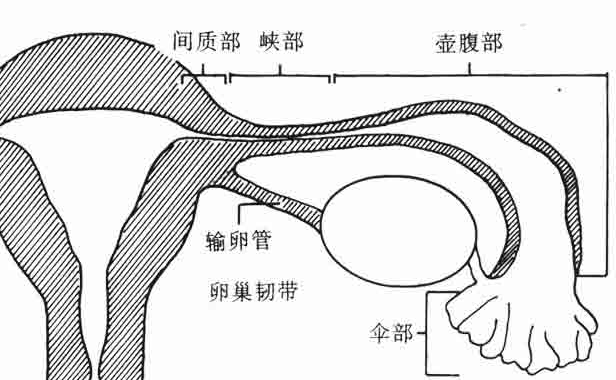 输卵管不通